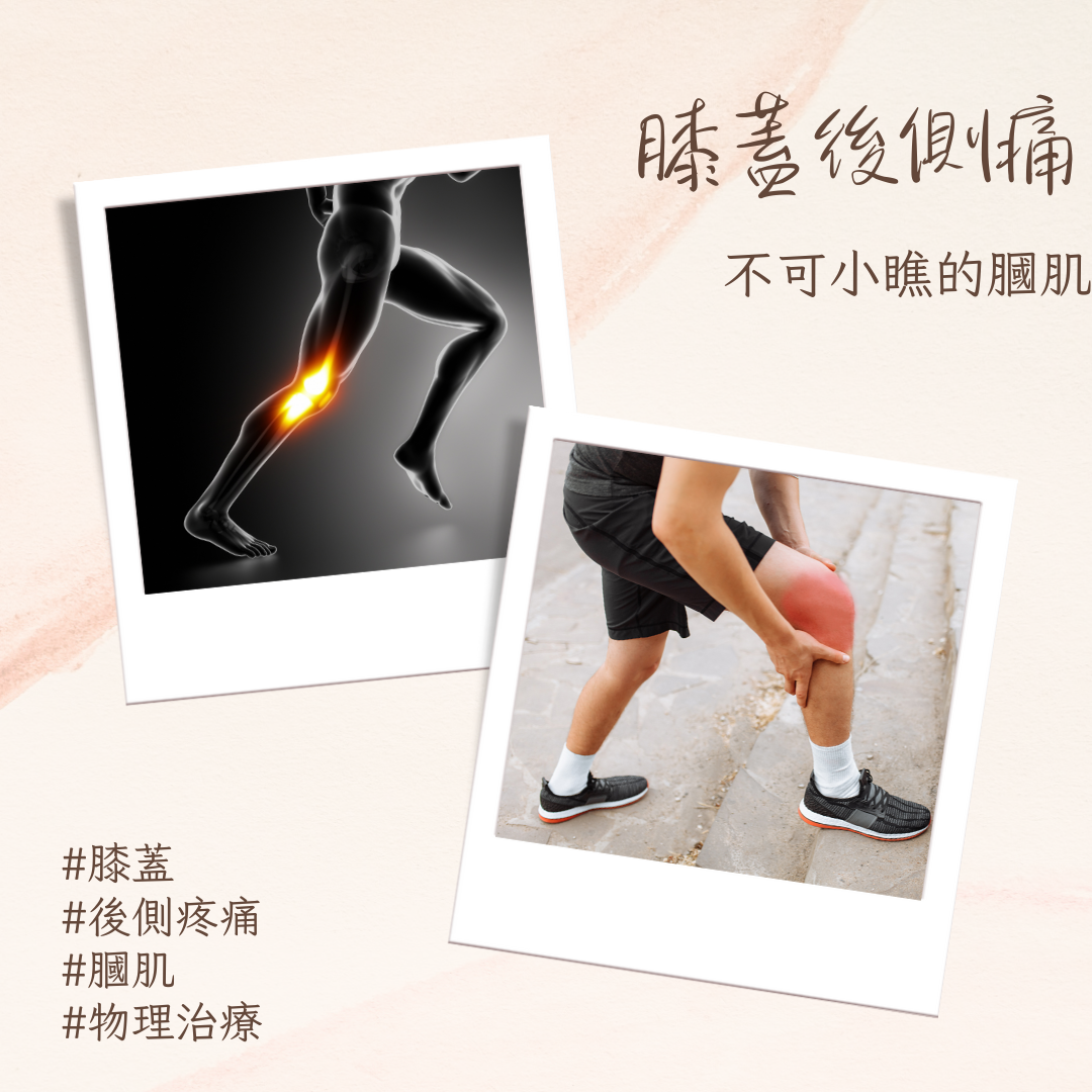 膝蓋後側痛,不可小瞧的膕肌